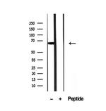 PHF19 Antibody in Western Blot (WB)