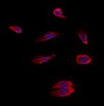 PMM2 Antibody in Immunocytochemistry (ICC/IF)