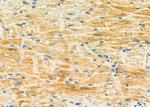 PMM2 Antibody in Immunohistochemistry (Paraffin) (IHC (P))