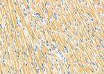 PMM2 Antibody in Immunohistochemistry (Paraffin) (IHC (P))