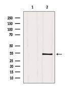 PMM2 Antibody in Western Blot (WB)