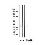 RAB12 Antibody in Western Blot (WB)