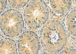 RBBP9 Antibody in Immunohistochemistry (Paraffin) (IHC (P))