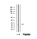 RBBP9 Antibody in Western Blot (WB)