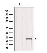 RBBP9 Antibody in Western Blot (WB)