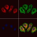 CRALBP Antibody in Immunocytochemistry (ICC/IF)