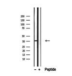 SGCG Antibody in Western Blot (WB)