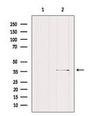 SGCG Antibody in Western Blot (WB)