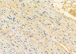 VDAC3 Antibody in Immunohistochemistry (Paraffin) (IHC (P))