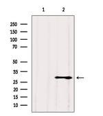 VDAC3 Antibody in Western Blot (WB)