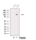 ORP6 Antibody in Western Blot (WB)