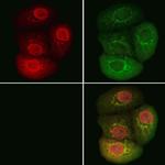 BCL9 Antibody in Immunocytochemistry (ICC/IF)