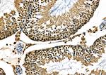 BCL9 Antibody in Immunohistochemistry (Paraffin) (IHC (P))