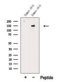 COL5A2 Antibody in Western Blot (WB)