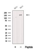 FBXL10 Antibody in Western Blot (WB)