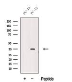 MSI2 Antibody in Western Blot (WB)