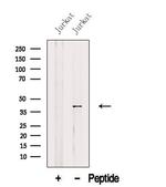 AUP1 Antibody in Western Blot (WB)