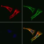 C19orf52 Antibody in Immunocytochemistry (ICC/IF)