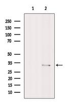 CHMP2B Antibody in Western Blot (WB)