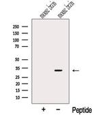 CHMP2B Antibody in Western Blot (WB)