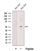 COQ6 Antibody in Western Blot (WB)