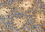 NG2 Antibody in Immunohistochemistry (Paraffin) (IHC (P))