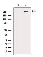 NG2 Antibody in Western Blot (WB)