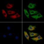 CTPS2 Antibody in Immunocytochemistry (ICC/IF)