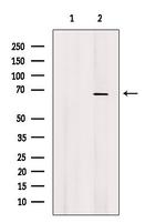 CTPS2 Antibody in Western Blot (WB)