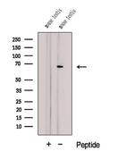 CTPS2 Antibody in Western Blot (WB)