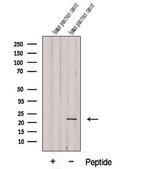 DDIT4L Antibody in Western Blot (WB)