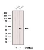 DUSP11 Antibody in Western Blot (WB)