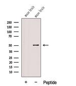 FADS1 Antibody in Western Blot (WB)