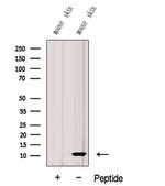 G0S2 Antibody in Western Blot (WB)