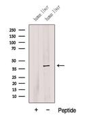 G6PC Antibody in Western Blot (WB)