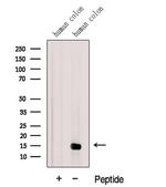 Galectin 2 Antibody in Western Blot (WB)