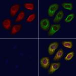 GGCX Antibody in Immunocytochemistry (ICC/IF)