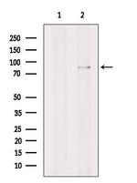 GGCX Antibody in Western Blot (WB)