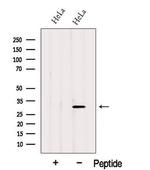 GSTO2 Antibody in Western Blot (WB)