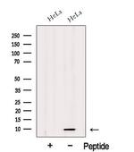 HIGD1A Antibody in Western Blot (WB)