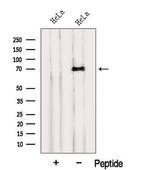 INTS10 Antibody in Western Blot (WB)