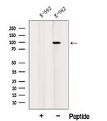 INVS Antibody in Western Blot (WB)