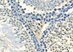 MED12 Antibody in Immunohistochemistry (Paraffin) (IHC (P))