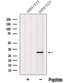 MITD1 Antibody in Western Blot (WB)