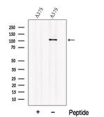 OSMR Antibody in Western Blot (WB)