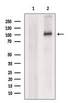 OSMR Antibody in Western Blot (WB)