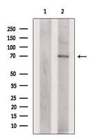 PLAGL2 Antibody in Western Blot (WB)