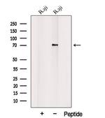 PLAGL2 Antibody in Western Blot (WB)