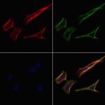 PRRT1 Antibody in Immunocytochemistry (ICC/IF)