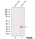 RABL3 Antibody in Western Blot (WB)